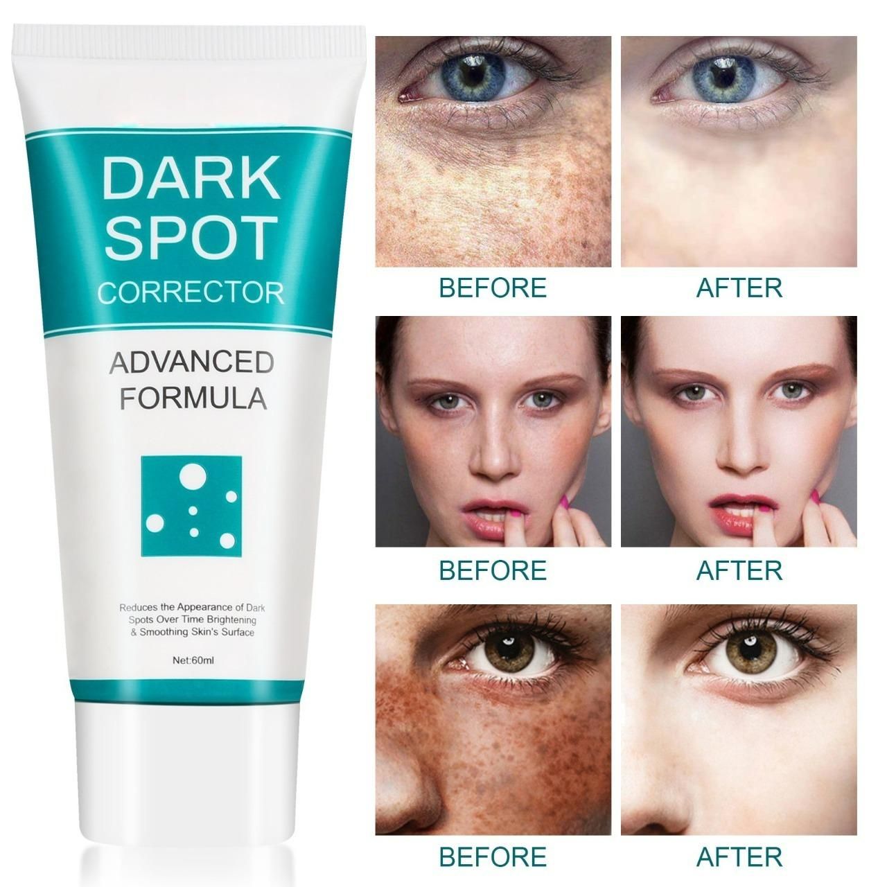 Dark Spot Corrector For Face 60 ml